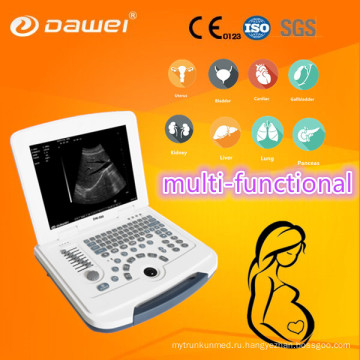 DW-580 медицинского оборудования, используемые для продажи, ultrasound